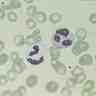 Granulocytes éosinophiles